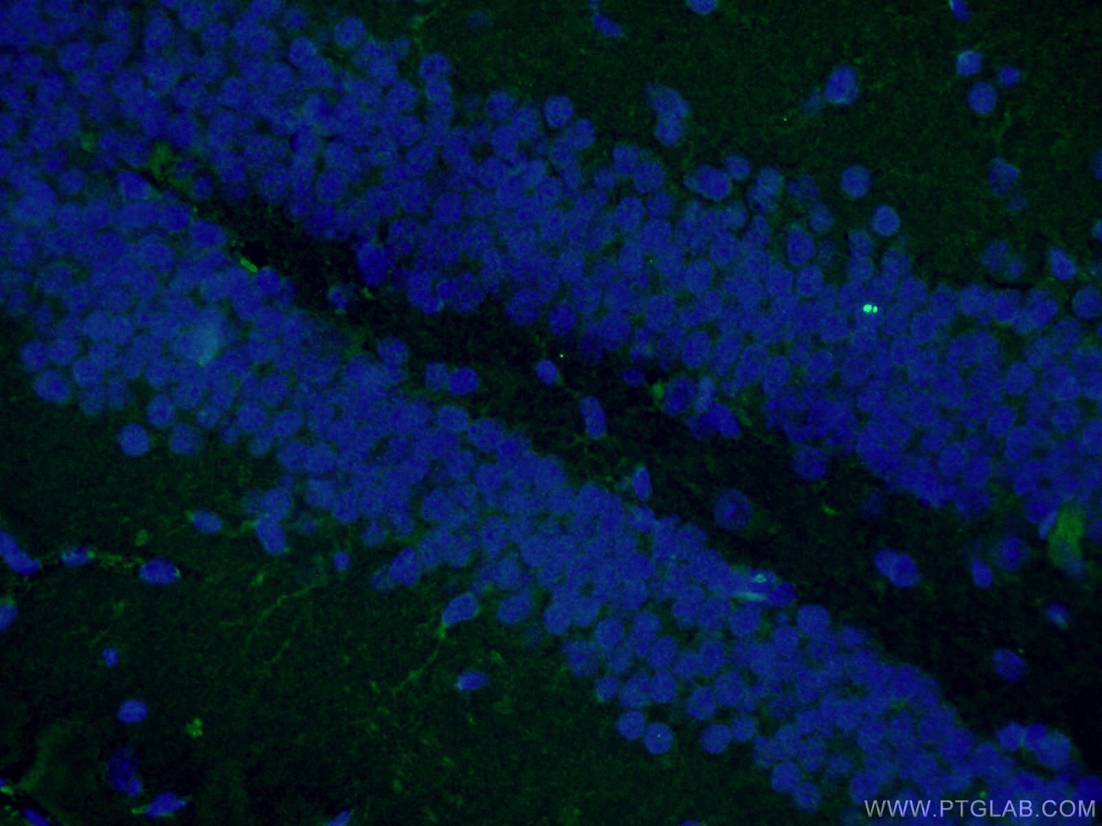 IF Staining of mouse brain using 19483-1-AP