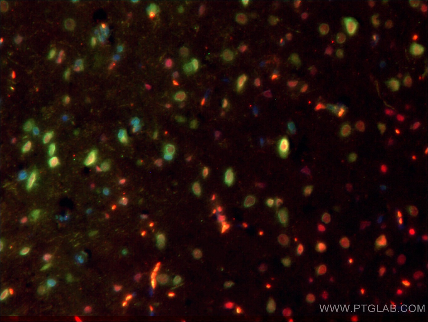 Immunofluorescence (IF) / fluorescent staining of rat brain tissue using Nestin Polyclonal antibody (19483-1-AP)