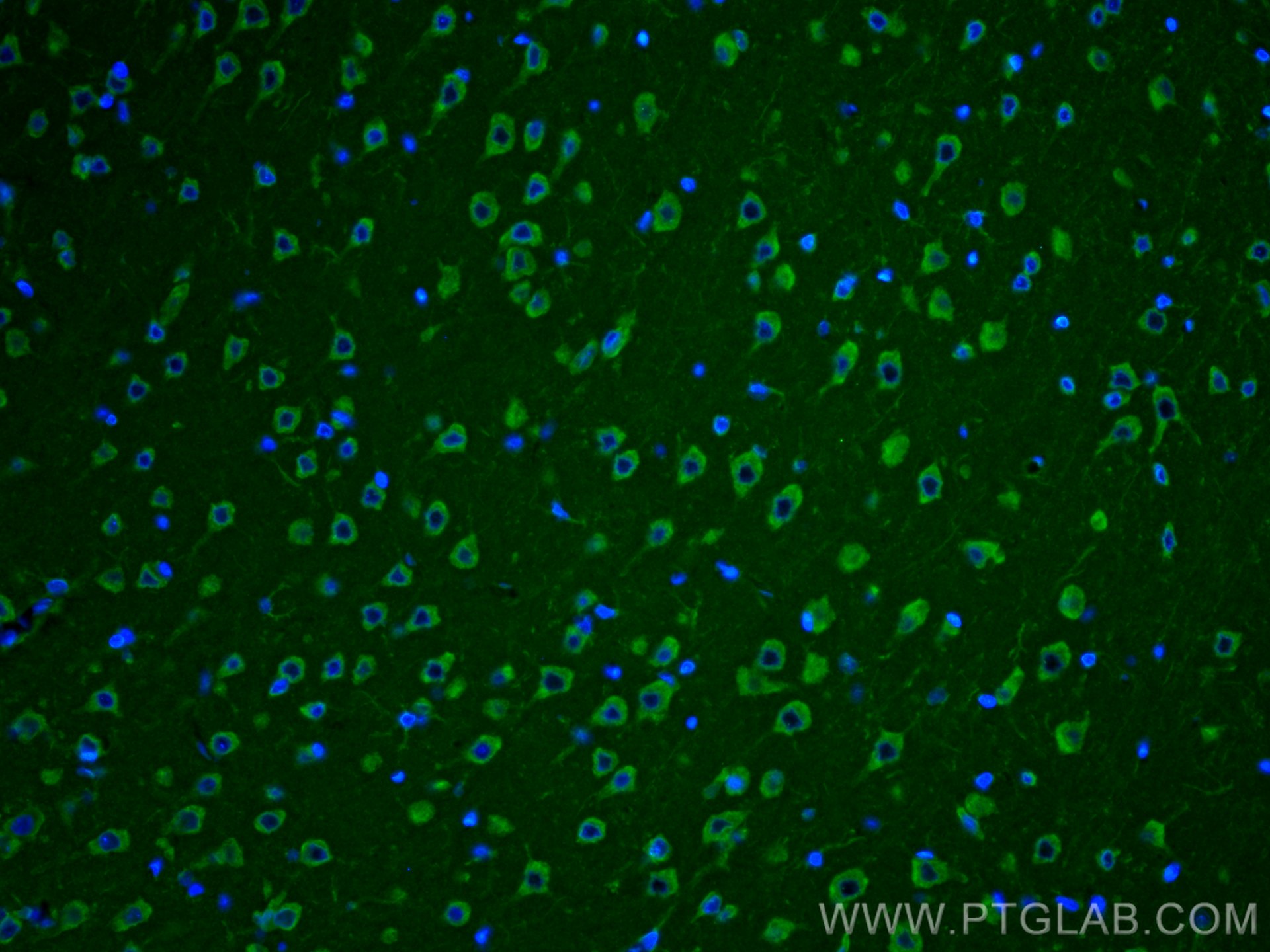 Immunofluorescence (IF) / fluorescent staining of rat brain tissue using Nestin Polyclonal antibody (19483-1-AP)