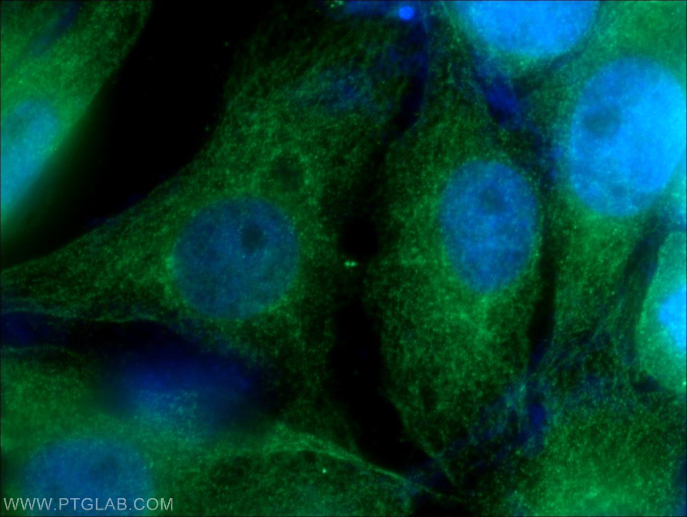 Immunofluorescence (IF) / fluorescent staining of SH-SY5Y cells using Nestin Polyclonal antibody (19483-1-AP)