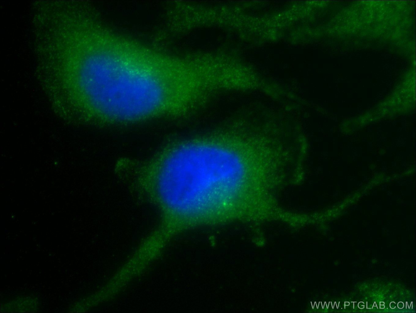 Immunofluorescence (IF) / fluorescent staining of U-251 cells using Nestin Polyclonal antibody (19483-1-AP)