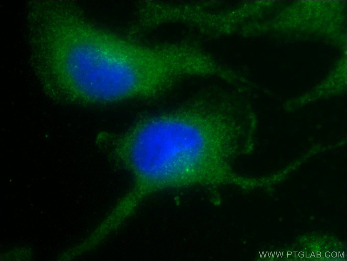 IF Staining of U-251 using 19483-1-AP