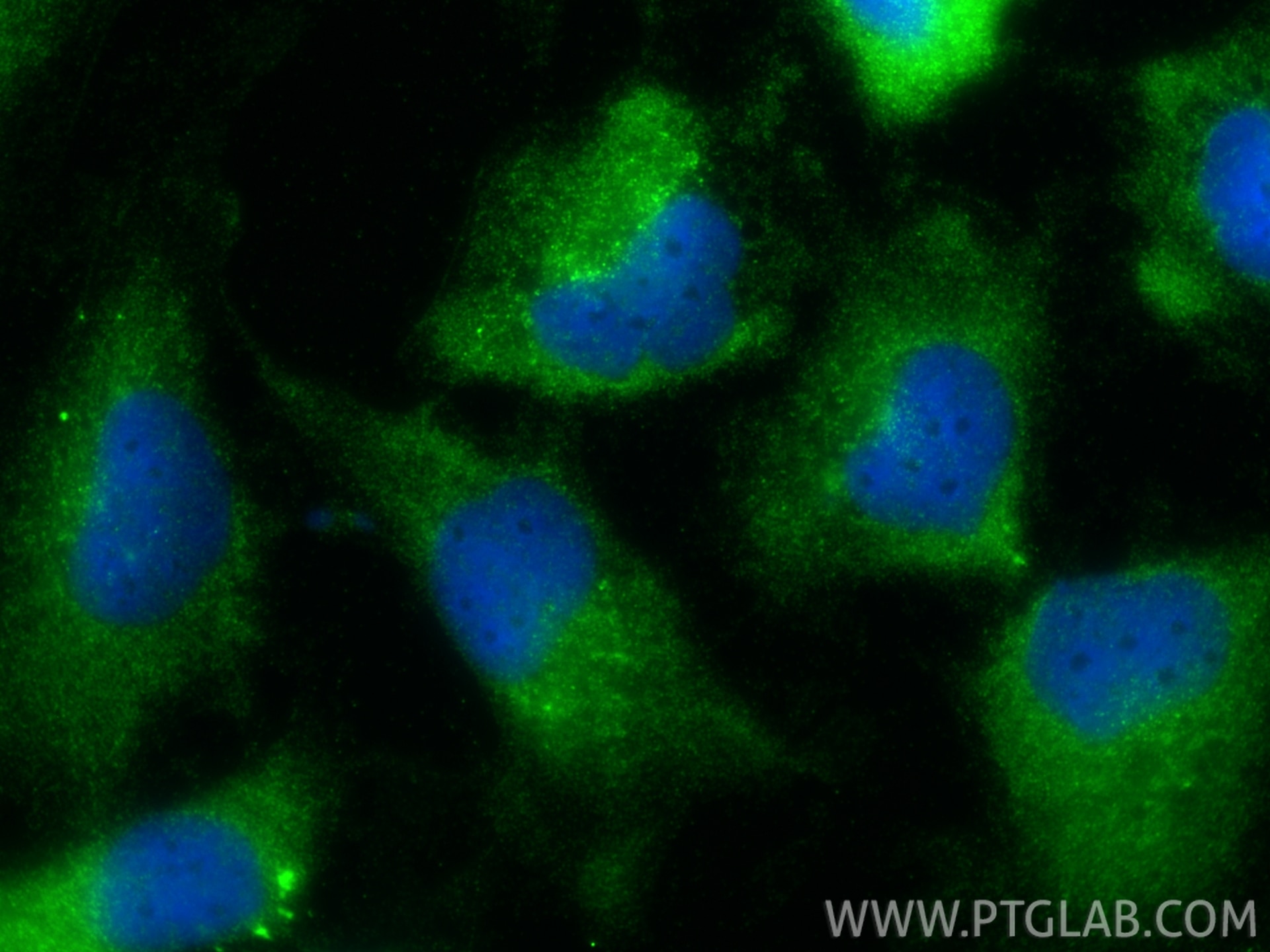 Immunofluorescence (IF) / fluorescent staining of U-251 cells using Nestin Polyclonal antibody (19483-1-AP)