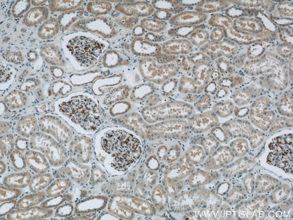 Immunohistochemistry (IHC) staining of human kidney tissue using Nestin Polyclonal antibody (19483-1-AP)