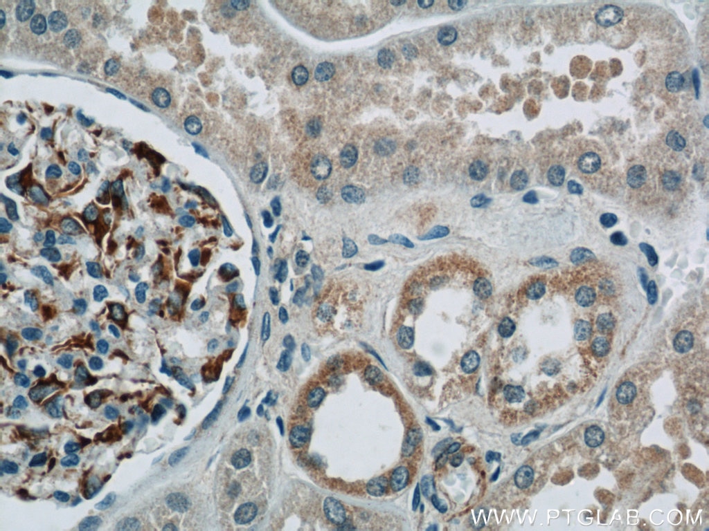 Immunohistochemistry (IHC) staining of human kidney tissue using Nestin Polyclonal antibody (19483-1-AP)