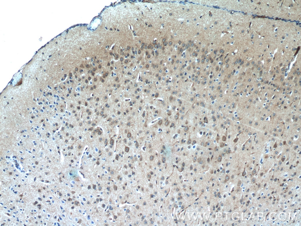Immunohistochemistry (IHC) staining of mouse brain tissue using Nestin Polyclonal antibody (19483-1-AP)