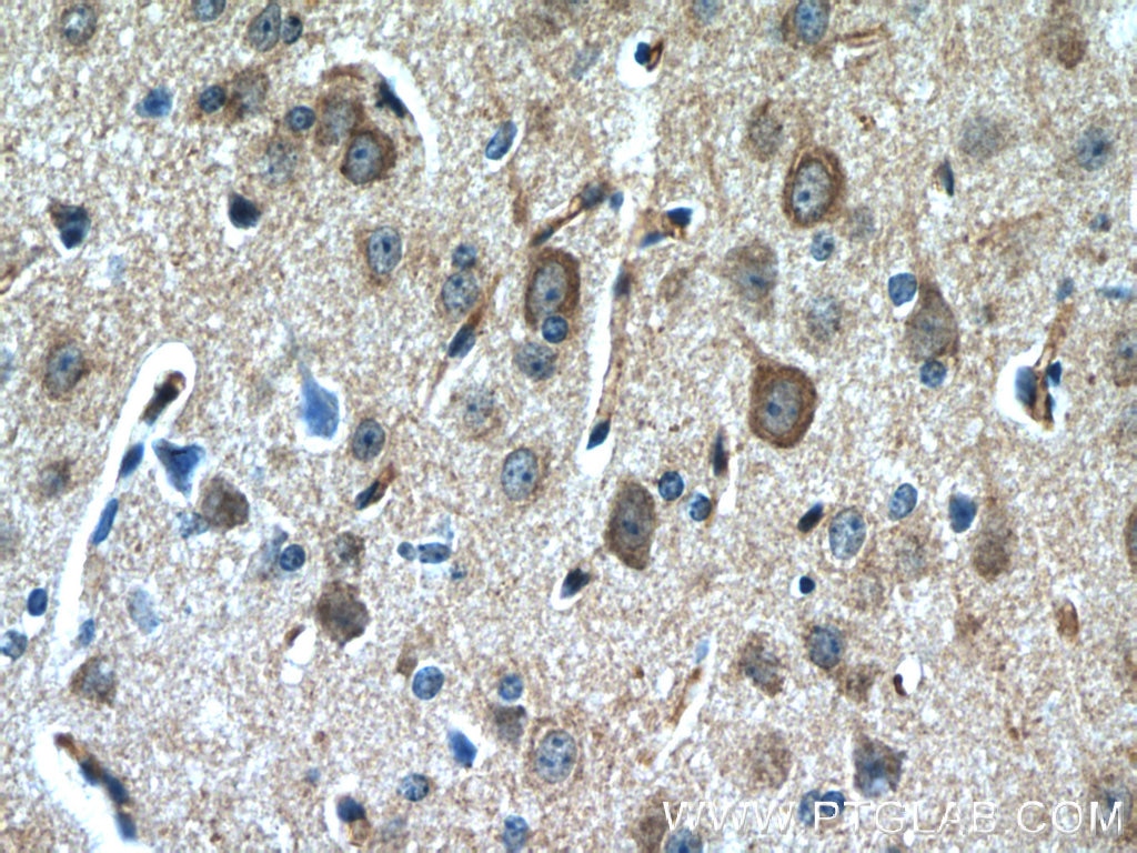 Immunohistochemistry (IHC) staining of mouse brain tissue using Nestin Polyclonal antibody (19483-1-AP)