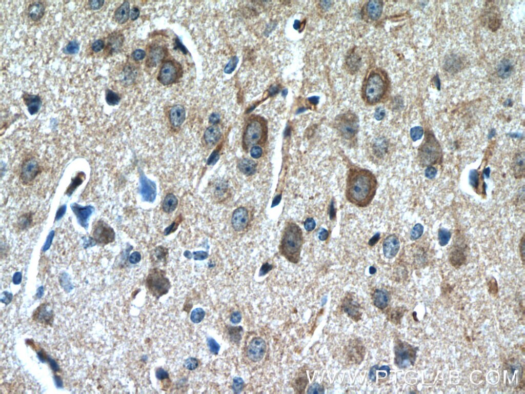 Immunohistochemistry (IHC) staining of mouse brain tissue using Nestin Polyclonal antibody (19483-1-AP)