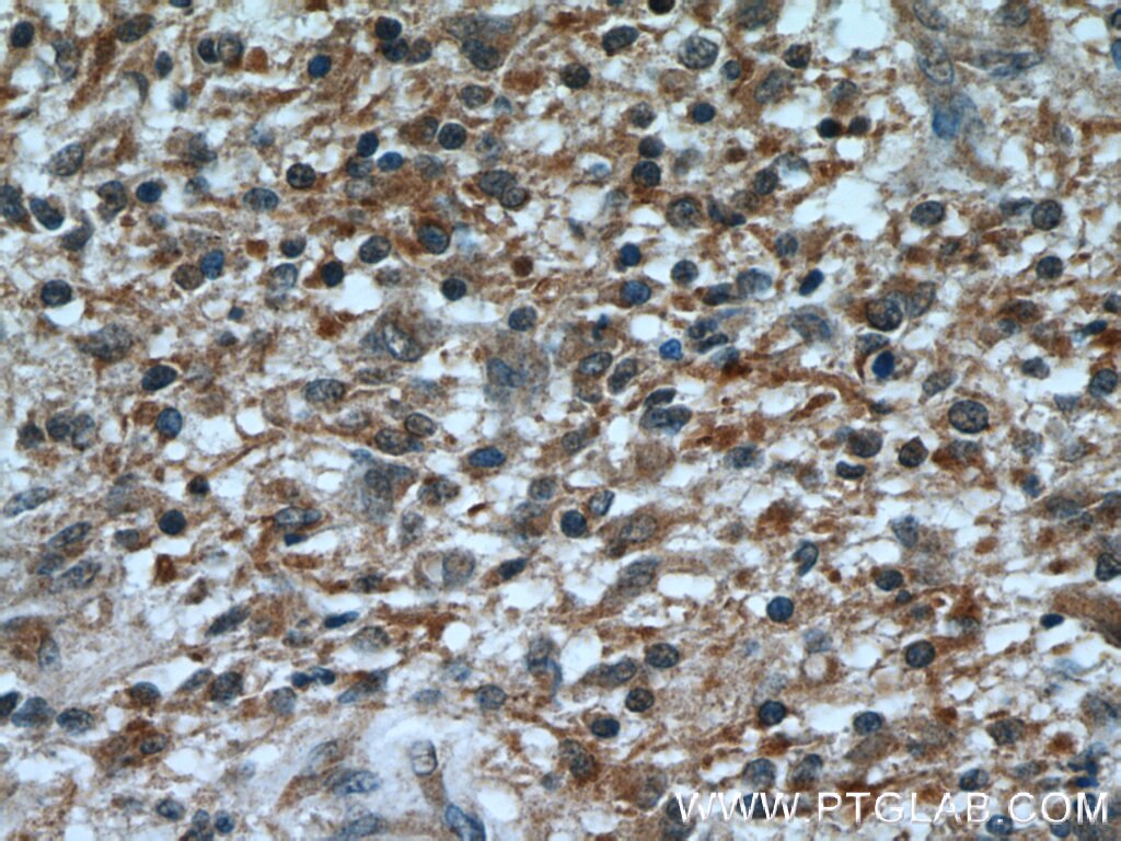 Nestin Polyclonal antibody