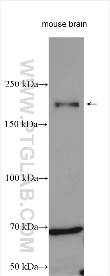 Western Blot (WB) analysis of various lysates using Nestin Polyclonal antibody (19483-1-AP)