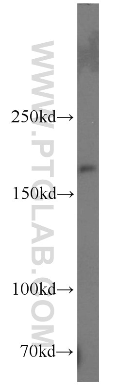 Western Blot (WB) analysis of rat brain tissue using Nestin Polyclonal antibody (19483-1-AP)