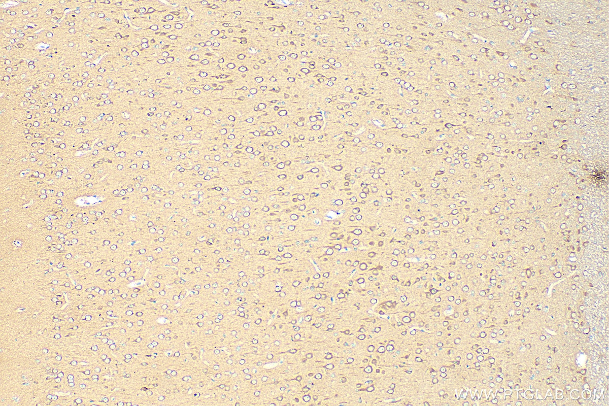 Immunohistochemistry (IHC) staining of rat brain tissue using NES Polyclonal antibody (30760-1-AP)