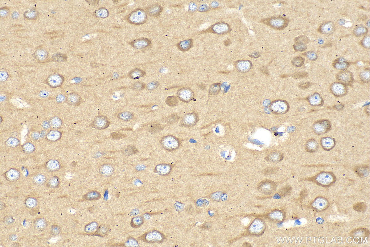 Immunohistochemistry (IHC) staining of rat brain tissue using Nestin Polyclonal antibody (30760-1-AP)