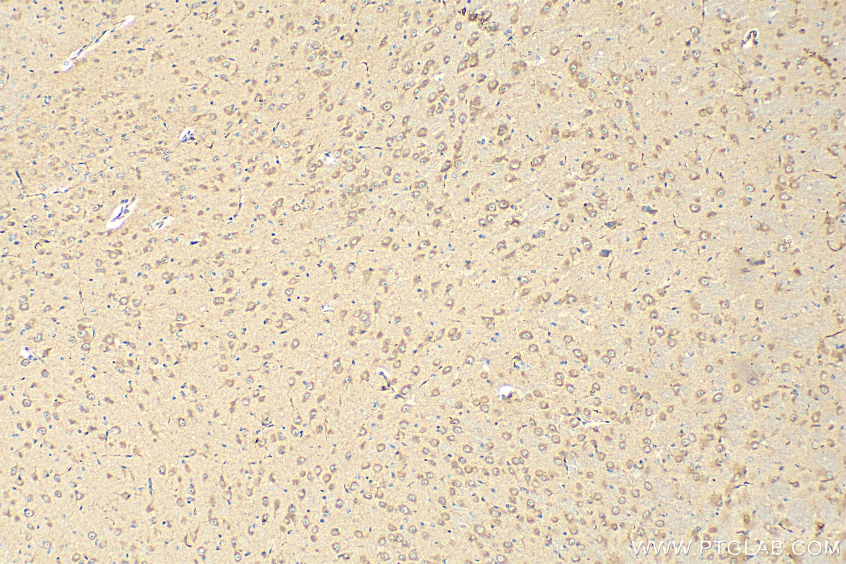 Immunohistochemistry (IHC) staining of mouse brain tissue using Nestin Polyclonal antibody (30760-1-AP)