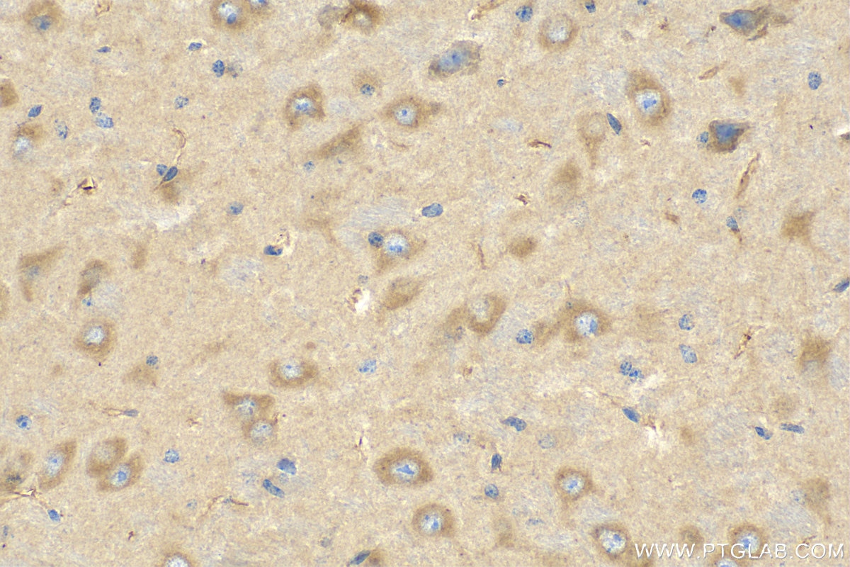 Immunohistochemistry (IHC) staining of mouse brain tissue using NES Polyclonal antibody (30760-1-AP)