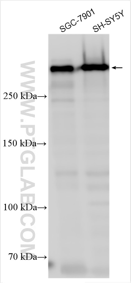 Western Blot (WB) analysis of various lysates using Nestin Polyclonal antibody (30760-1-AP)