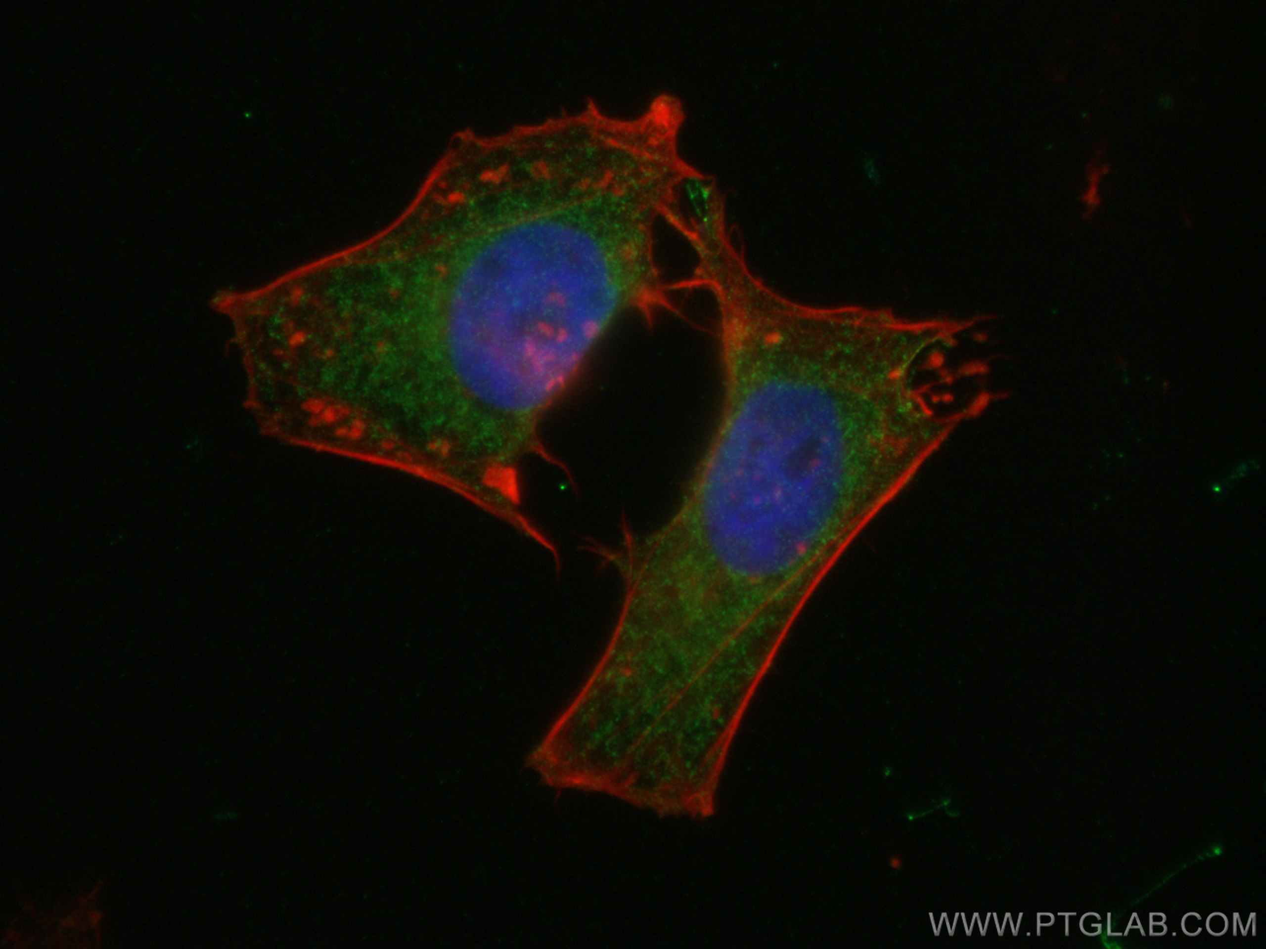Immunofluorescence (IF) / fluorescent staining of HeLa cells using GNAS Polyclonal antibody (10150-2-AP)