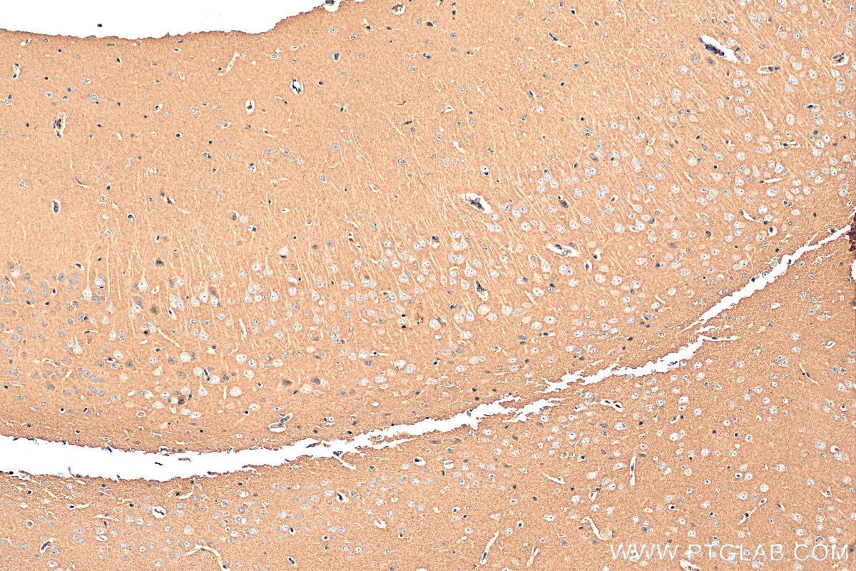 Immunohistochemistry (IHC) staining of mouse brain tissue using GNAS Polyclonal antibody (10150-2-AP)