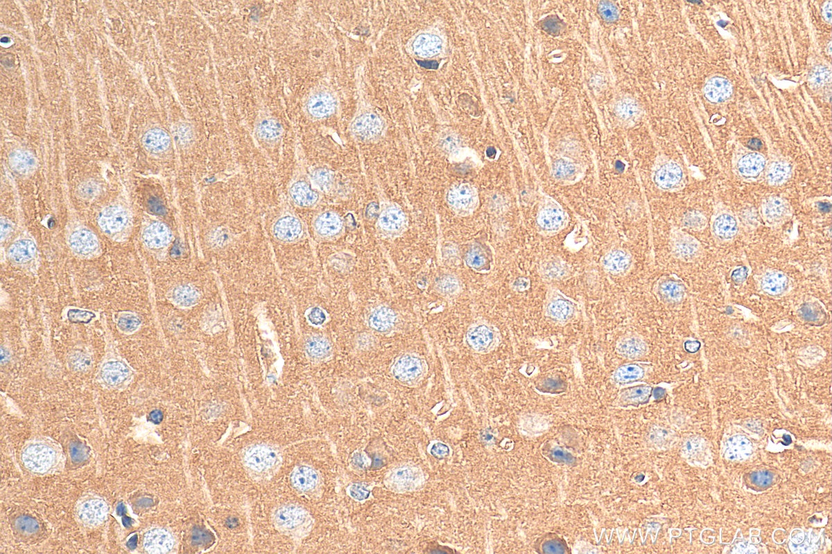 Immunohistochemistry (IHC) staining of mouse brain tissue using GNAS Polyclonal antibody (10150-2-AP)