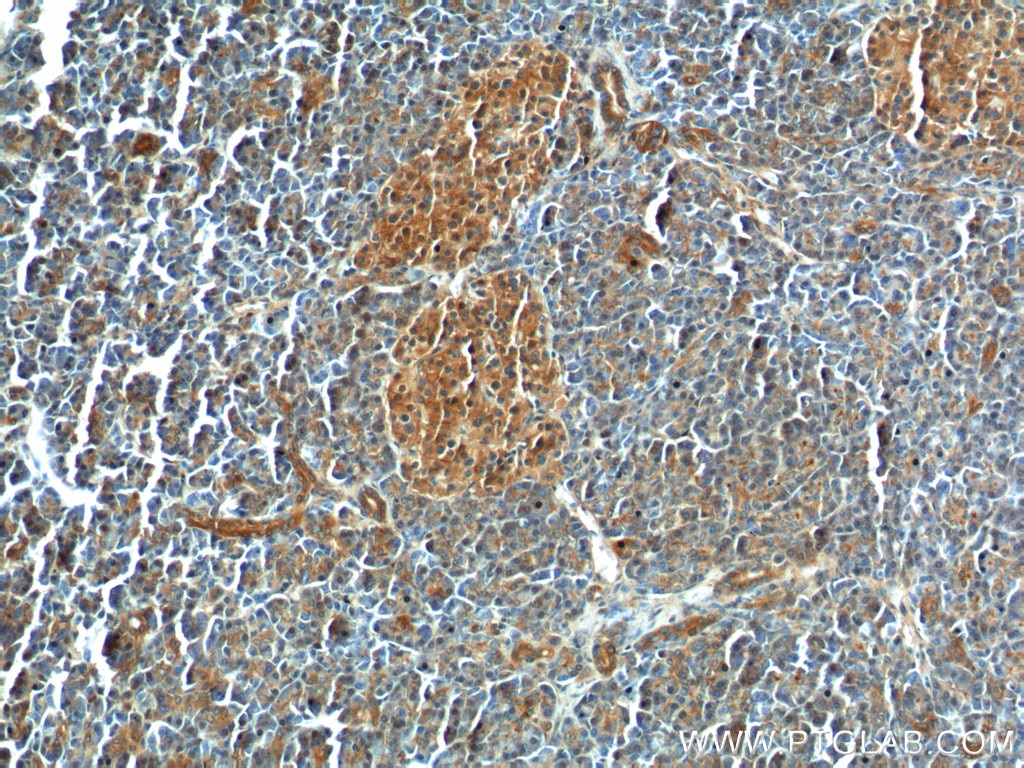 Immunohistochemistry (IHC) staining of human pancreas tissue using GNAS Polyclonal antibody (10150-2-AP)