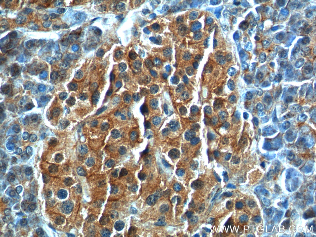 Immunohistochemistry (IHC) staining of human pancreas tissue using GNAS Polyclonal antibody (10150-2-AP)