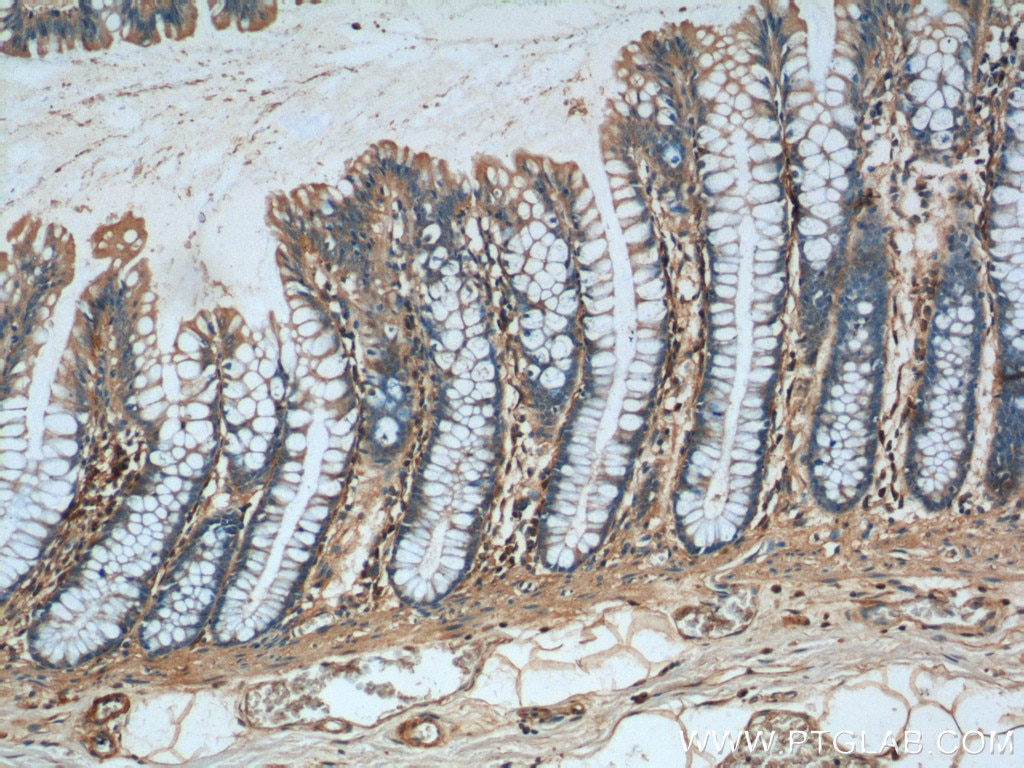 IHC staining of human colon using 10150-2-AP