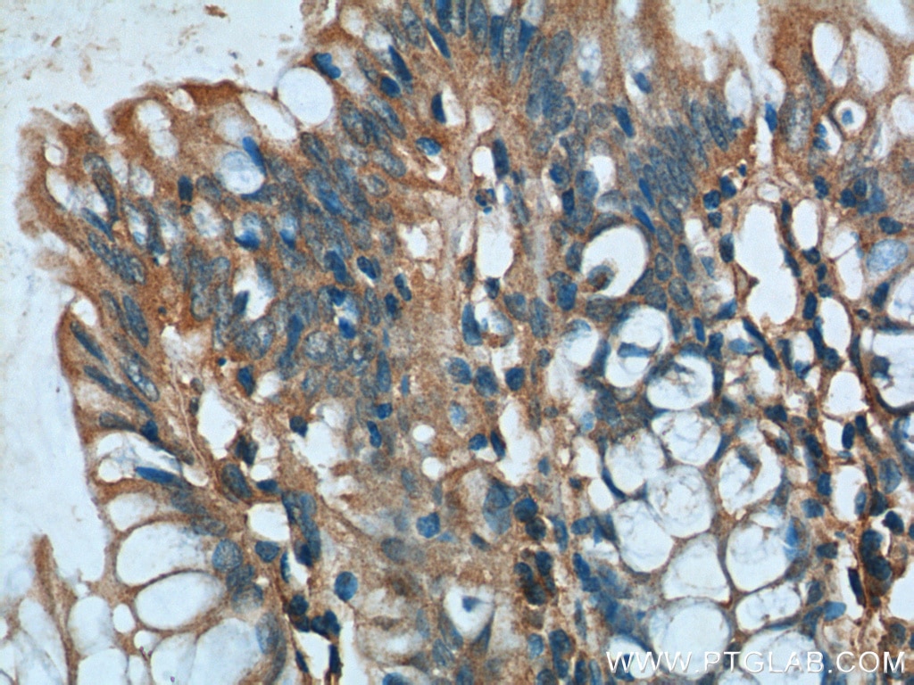 Immunohistochemistry (IHC) staining of human colon tissue using GNAS Polyclonal antibody (10150-2-AP)
