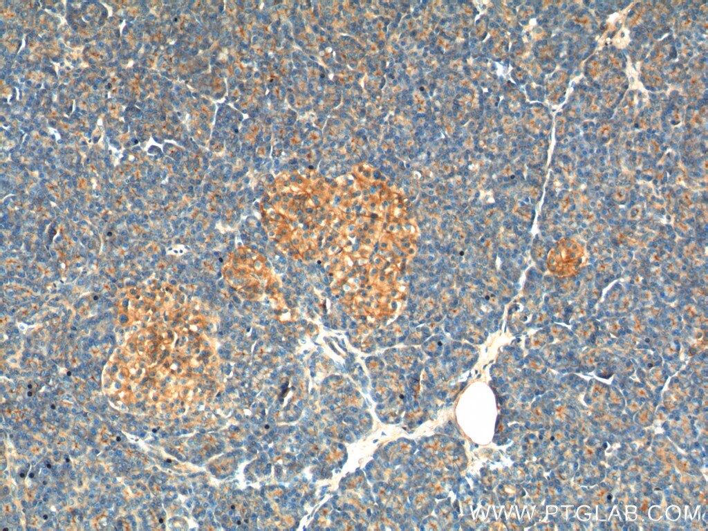 Immunohistochemistry (IHC) staining of human pancreas tissue using GNAS Polyclonal antibody (10150-2-AP)