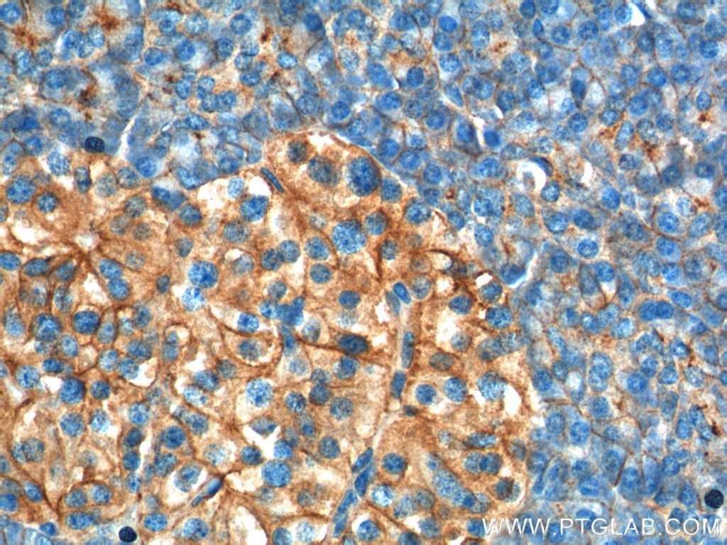 Immunohistochemistry (IHC) staining of human pancreas tissue using GNAS Polyclonal antibody (10150-2-AP)