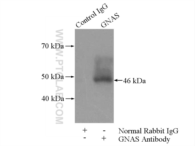 Immunoprecipitation (IP) experiment of mouse liver tissue using GNAS Polyclonal antibody (10150-2-AP)