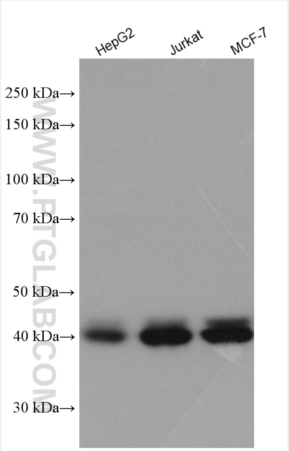 Western Blot (WB) analysis of various lysates using GNAS Polyclonal antibody (10150-2-AP)