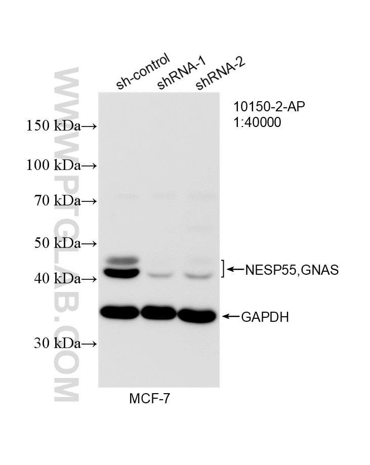 Western Blot (WB) analysis of MCF-7 cells using GNAS Polyclonal antibody (10150-2-AP)