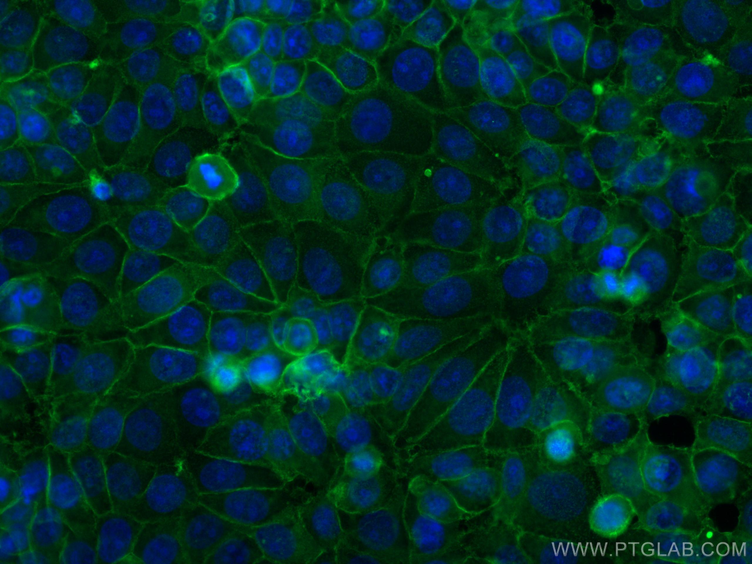 Immunofluorescence (IF) / fluorescent staining of MCF-7 cells using GNAS Monoclonal antibody (66253-1-Ig)