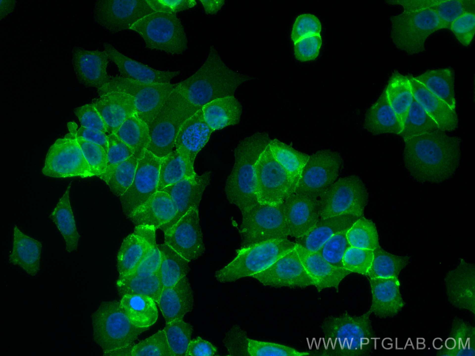 Immunofluorescence (IF) / fluorescent staining of MCF-7 cells using GNAS Monoclonal antibody (66253-1-Ig)