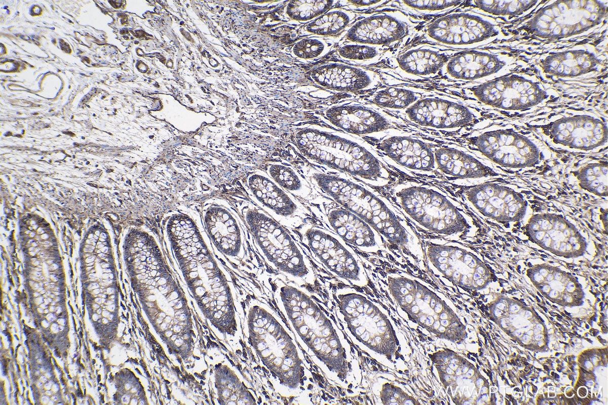 Immunohistochemistry (IHC) staining of human colon tissue using GNAS Monoclonal antibody (66253-1-Ig)