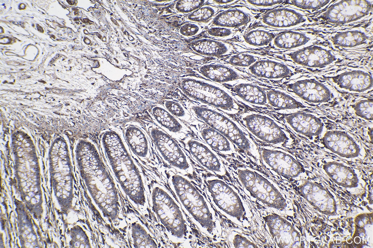 IHC staining of human colon using 66253-1-Ig