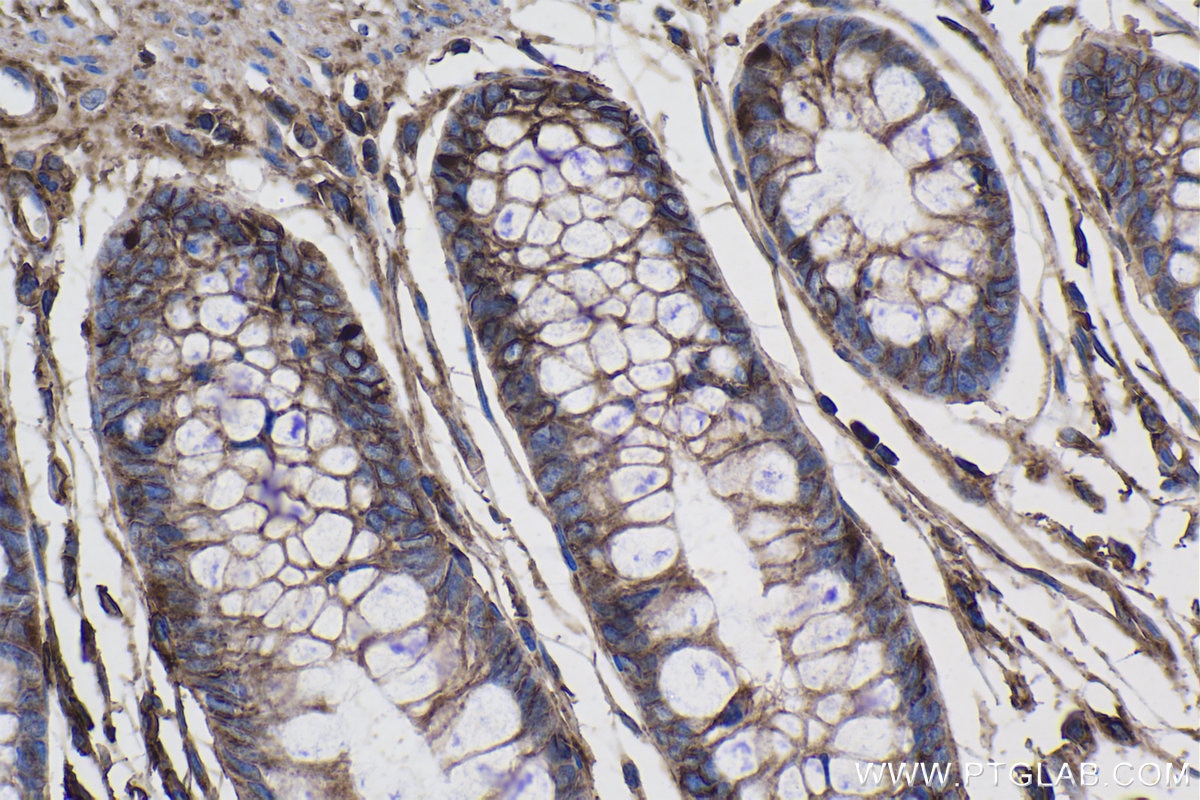 Immunohistochemistry (IHC) staining of human colon tissue using GNAS Monoclonal antibody (66253-1-Ig)