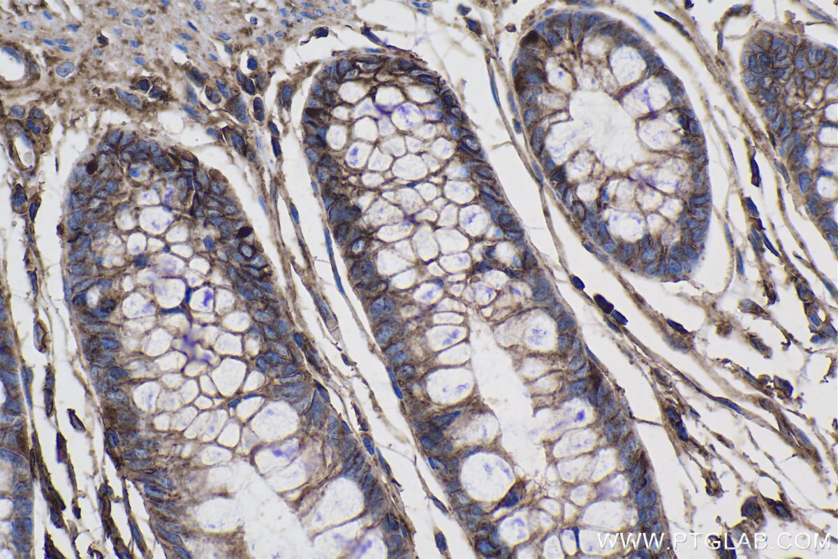 IHC staining of human colon using 66253-1-Ig