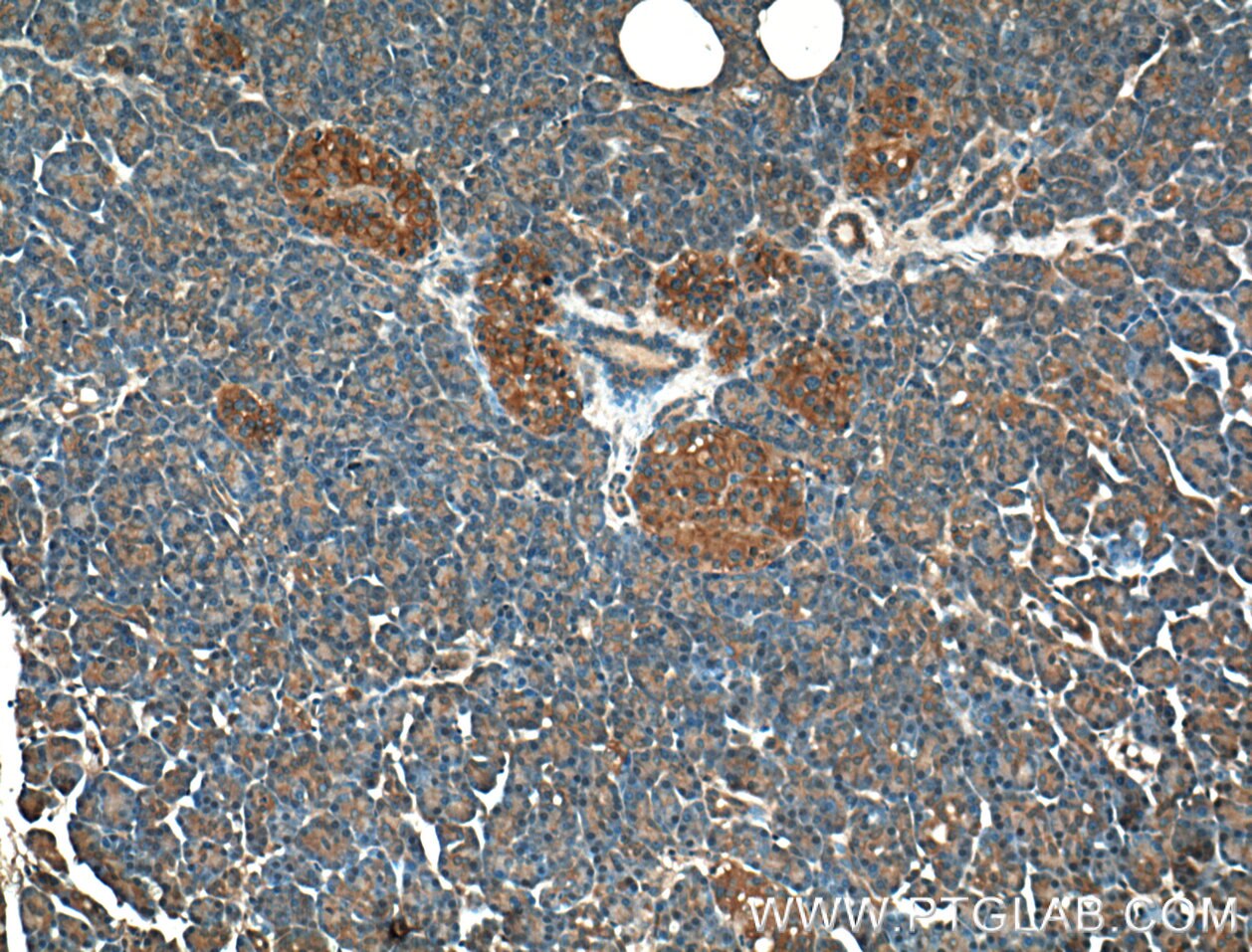 Immunohistochemistry (IHC) staining of human pancreas tissue using GNAS Monoclonal antibody (66253-1-Ig)