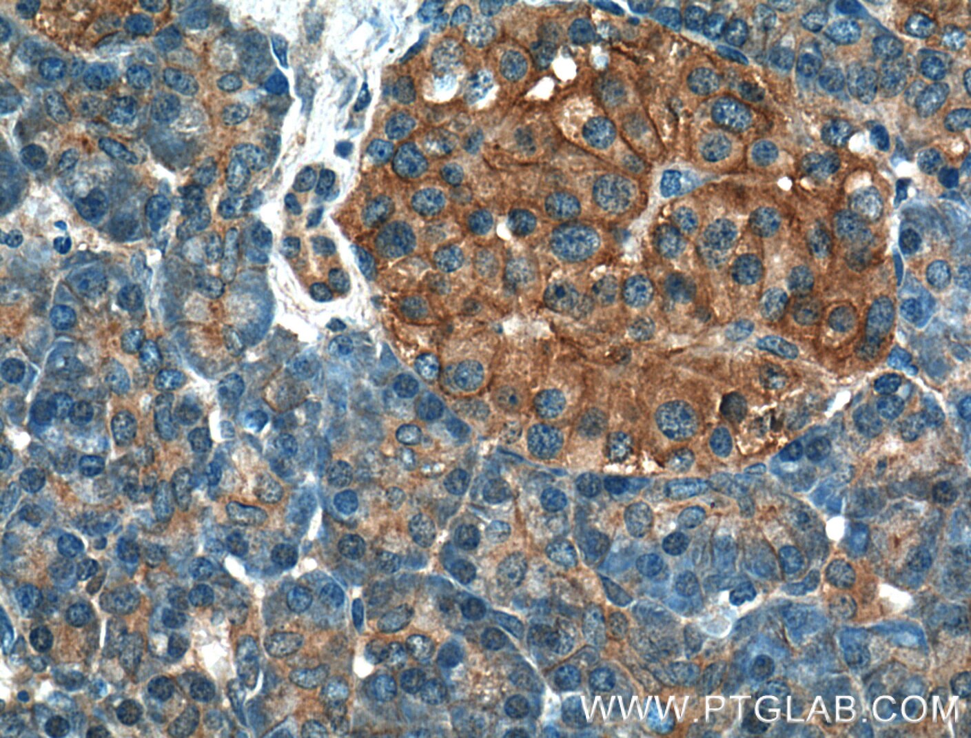Immunohistochemistry (IHC) staining of human pancreas tissue using GNAS Monoclonal antibody (66253-1-Ig)
