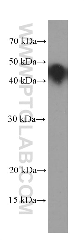 Western Blot (WB) analysis of pig brain tissue using GNAS Monoclonal antibody (66253-1-Ig)