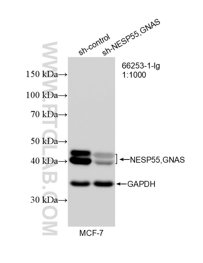 WB analysis of MCF-7 using 66253-1-Ig Western Blot (WB) analysis of MCF-7 cells using GNAS Monoclonal antibody (66253-1-Ig)
