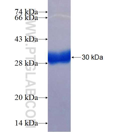 NESP55,GNAS fusion protein Ag25858 SDS-PAGE