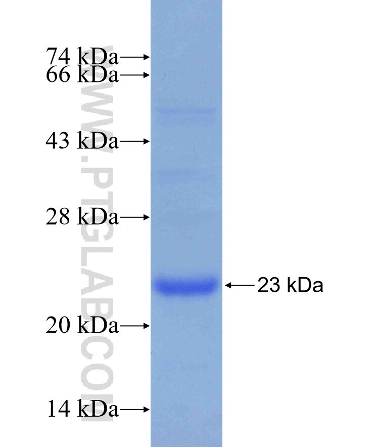 NESP55,GNAS fusion protein Ag20530 SDS-PAGE