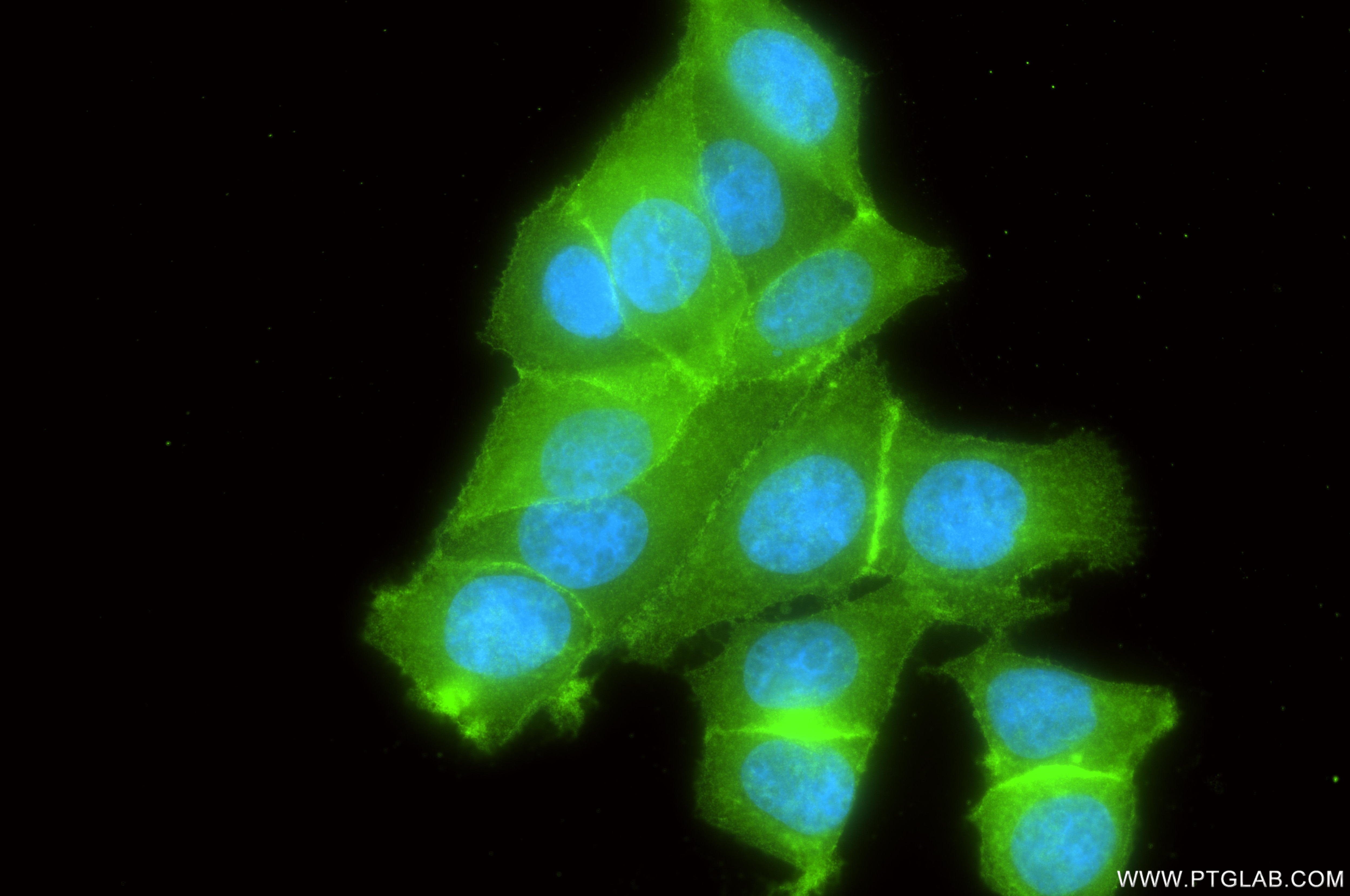 IF Staining of MCF-7 using 81802-2-RR (same clone as 81802-2-PBS) Immunofluorescence (IF) / fluorescent staining of MCF-7 cells using NESP55,GNAS Recombinant monoclonal antibody (81802-2-RR)