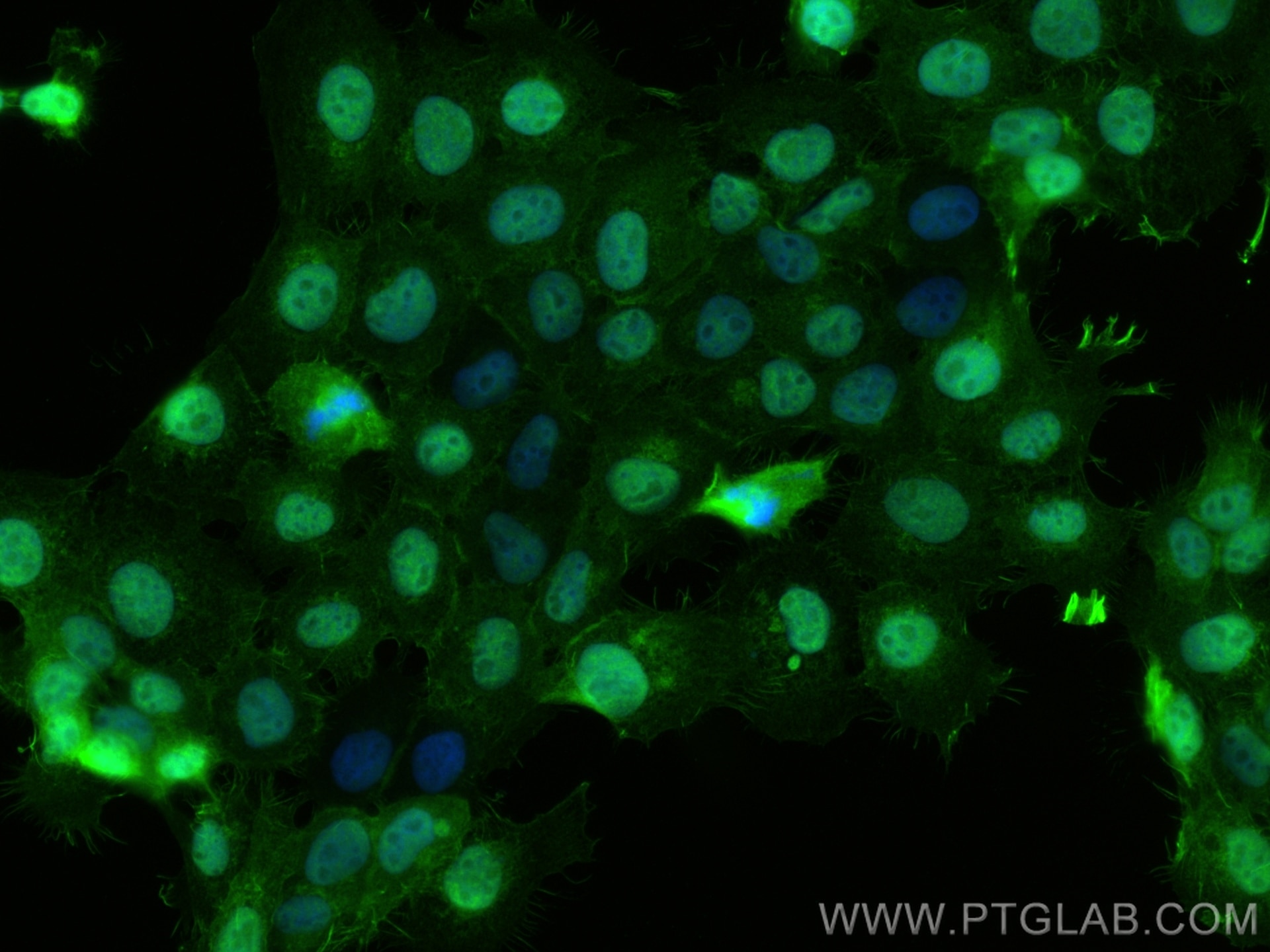 Immunofluorescence (IF) / fluorescent staining of A431 cells using NET1 Polyclonal antibody (12740-1-AP)