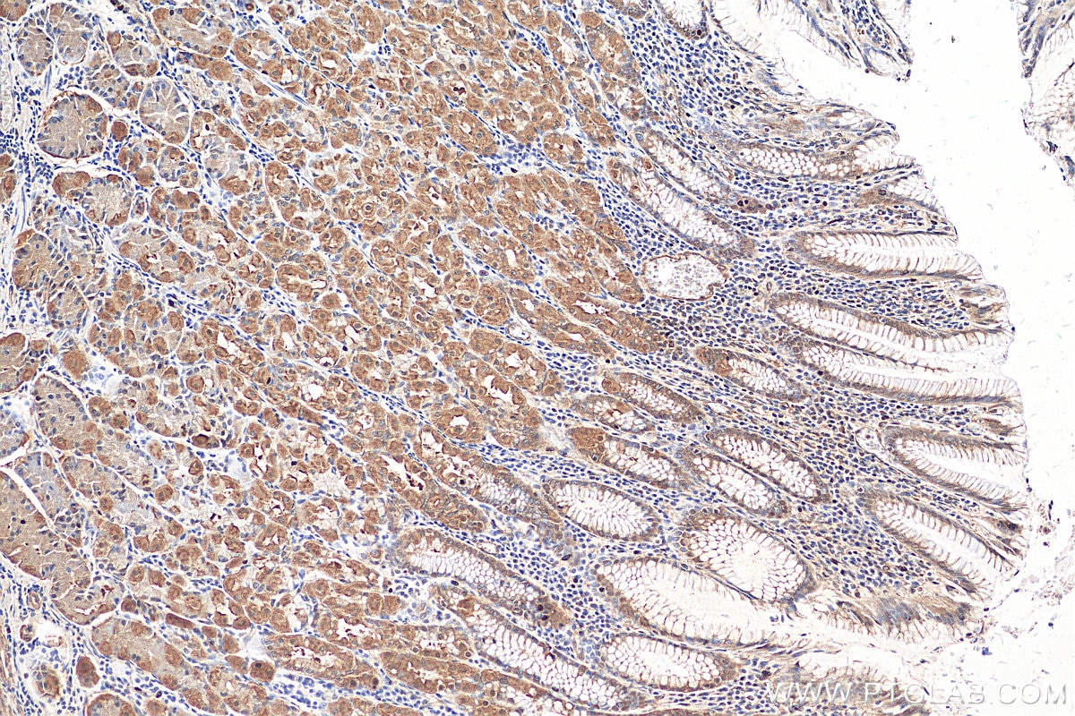 Immunohistochemistry (IHC) staining of human stomach tissue using NET1 Polyclonal antibody (12740-1-AP)