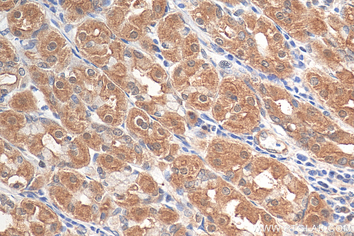 Immunohistochemistry (IHC) staining of human stomach tissue using NET1 Polyclonal antibody (12740-1-AP)