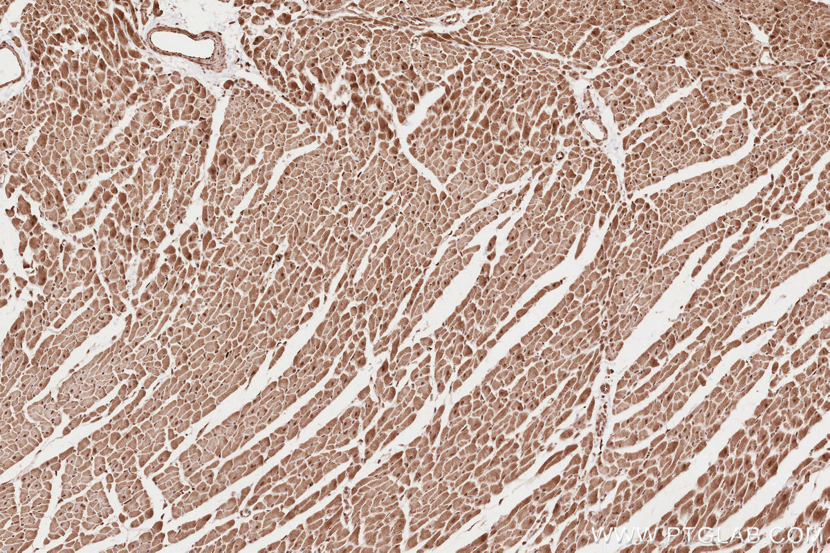 Immunohistochemistry (IHC) staining of rat heart tissue using NET1 Polyclonal antibody (12740-1-AP)