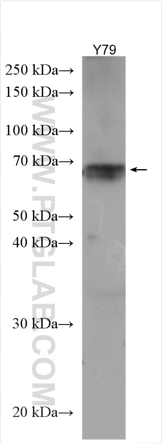 Western Blot (WB) analysis of Y79 cells using NET1 Polyclonal antibody (12740-1-AP)
